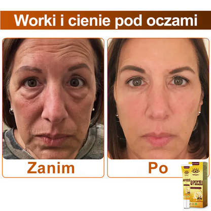 ✨💛✨OczyGlow™ Krem pod oczy z kolagen + jadem pszczelim - Certyfikat CE - Odpowiedni do wszystkich typów skóry