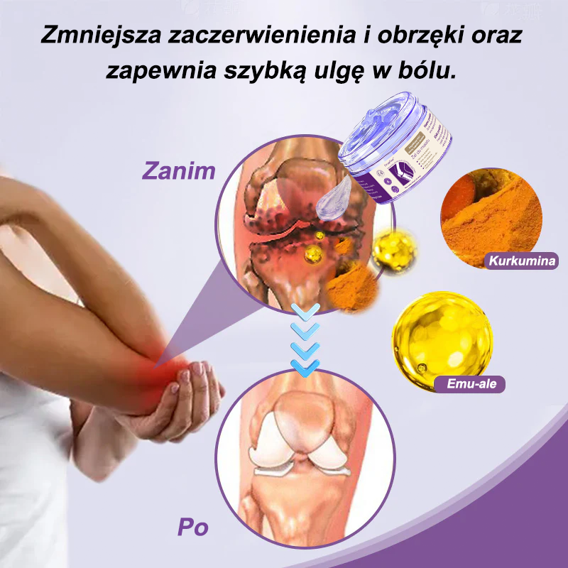 💜OruaFlex™ Kurkuma & Olej Emu Żel do masażu łagodzący ból i stany zapalne stawów👨‍⚕️Certyfikowany przez Polskie Towarzystwo Ortopedyczne i Traumatologiczne (PTOiTr)