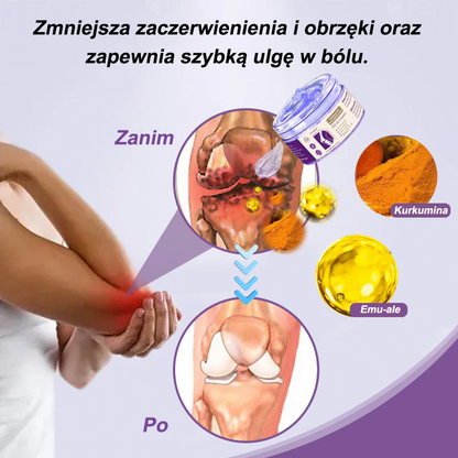 💜OruaFlex™ Kurkuma & Olej Emu Żel do masażu łagodzący ból i stany zapalne stawów👨‍⚕️Certyfikowany przez Polskie Towarzystwo Ortopedyczne i Traumatologiczne (PTOiTr)