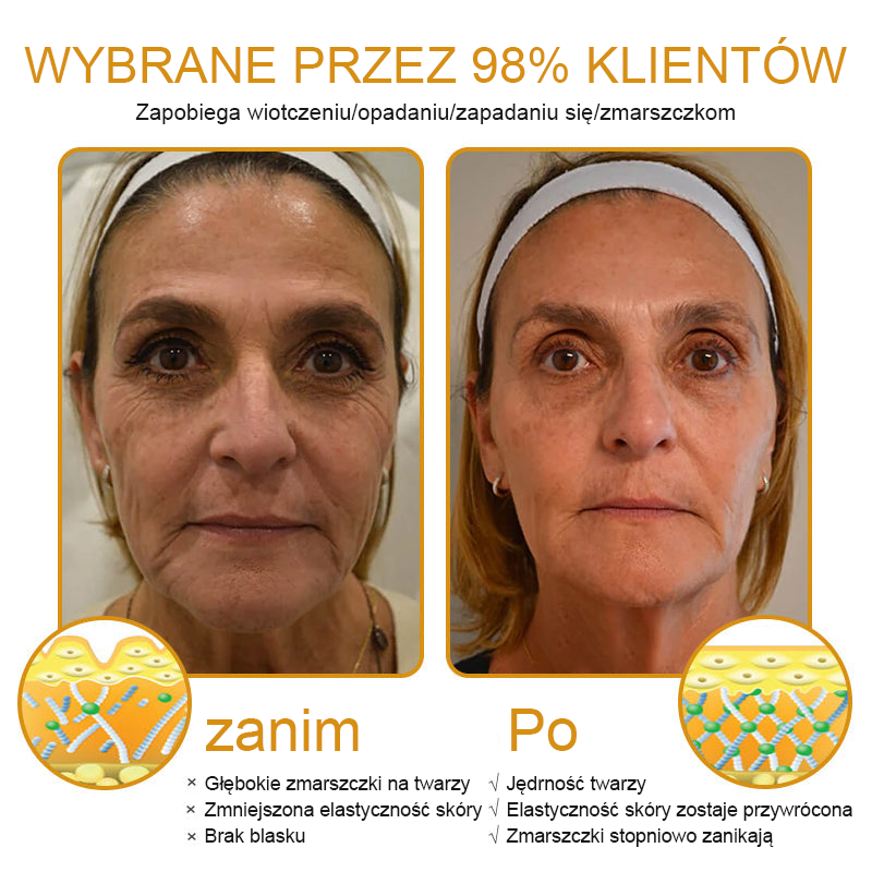 💛FrissArc™ Botox Miód Pszczelego Krem przeciwzmarszczkowy - Redukuje zmarszczki, ujędrnia skórę i rozjaśnia cerę ( Przeciwstarzeniowy krem o podwójnym działaniu )