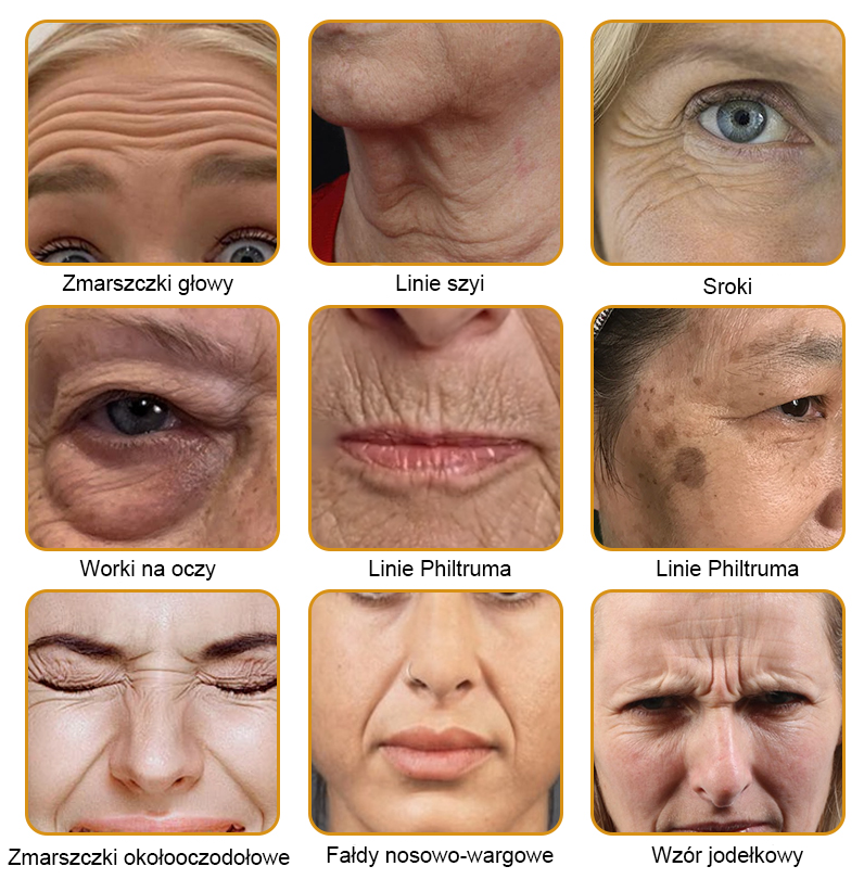 💛FrissArc™ Botox Miód Pszczelego Krem przeciwzmarszczkowy - Redukuje zmarszczki, ujędrnia skórę i rozjaśnia cerę ( Przeciwstarzeniowy krem o podwójnym działaniu )