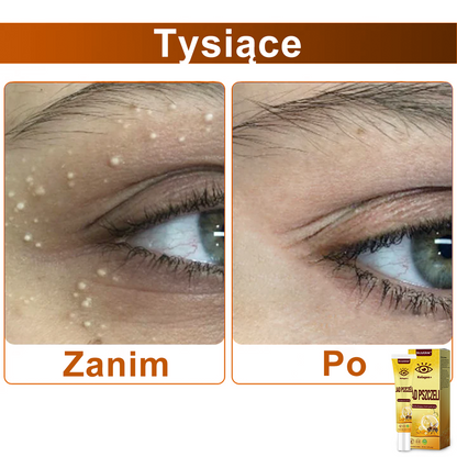 ✨💛✨OczyGlow™ Krem pod oczy z kolagen + jadem pszczelim - Certyfikat CE - Odpowiedni do wszystkich typów skóry