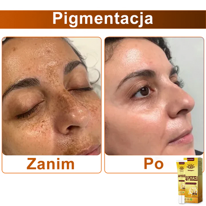 ✨💛✨OczyGlow™ Krem pod oczy z kolagen + jadem pszczelim - Certyfikat CE - Odpowiedni do wszystkich typów skóry