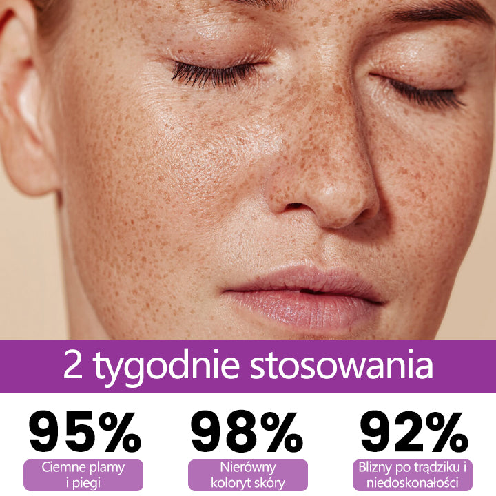 💜 Ceoerty® MelantraX Zaawansowana esencja przeciw przebarwieniom ✅ Skuteczna walka z przebarwieniami, ciemnymi plamami i nierównym kolorytem skóry