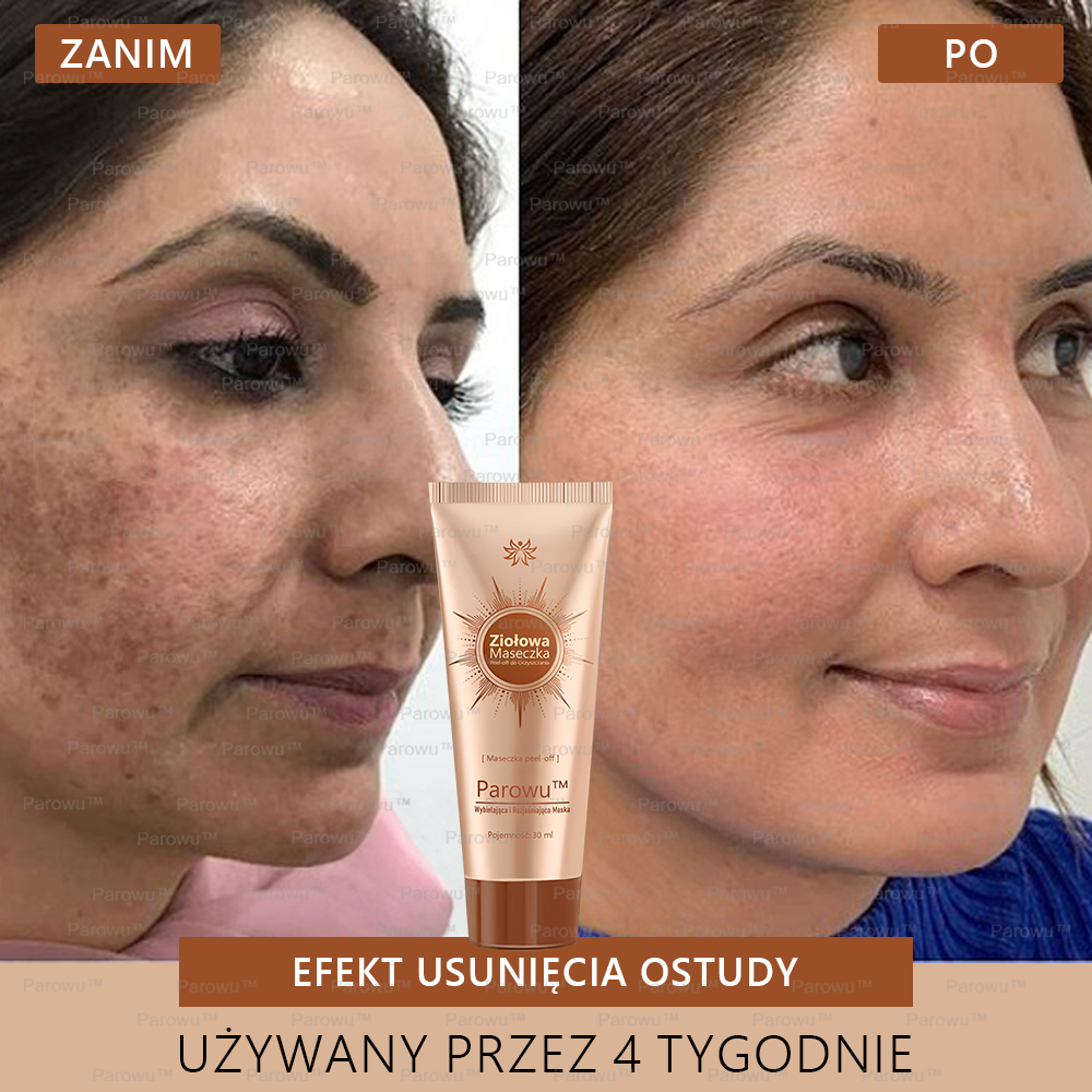 ✨🌙Parowu™ Wybielająca i Rozjaśniająca Maska - Naturalne składniki trwale usuwają plamy, piegi i przebarwienia