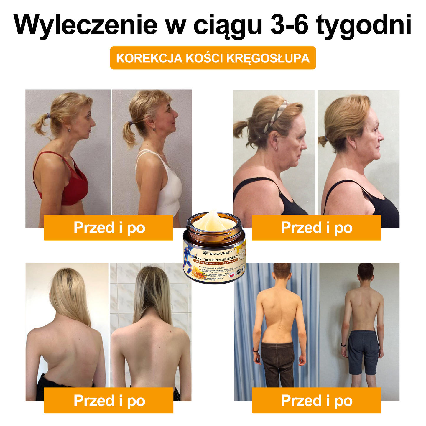 ✨🐝✨𝑺𝒕𝒂𝒘𝑽𝒊𝒕𝒂𝒍™ Krem z Jadem Pszczelim Leczniczy do Regeneracji Stawów - Zalecane przez Polskie Towarzystwo Ortopedyczne i Traumatologiczne