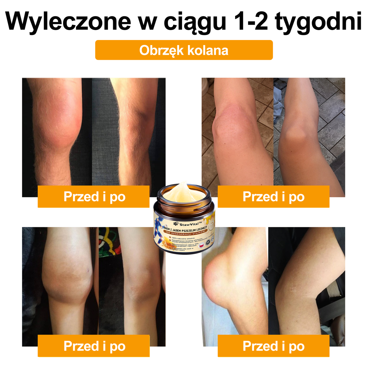 ✨🐝✨𝑺𝒕𝒂𝒘𝑽𝒊𝒕𝒂𝒍™ Krem z Jadem Pszczelim Leczniczy do Regeneracji Stawów - Zalecane przez Polskie Towarzystwo Ortopedyczne i Traumatologiczne