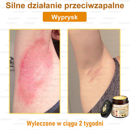 🐝FOVHEAl™ Krem wielofunkcyjny z jadem pszczelim - Polecane przez dermatologów – Odpowiednie dla każdego wieku