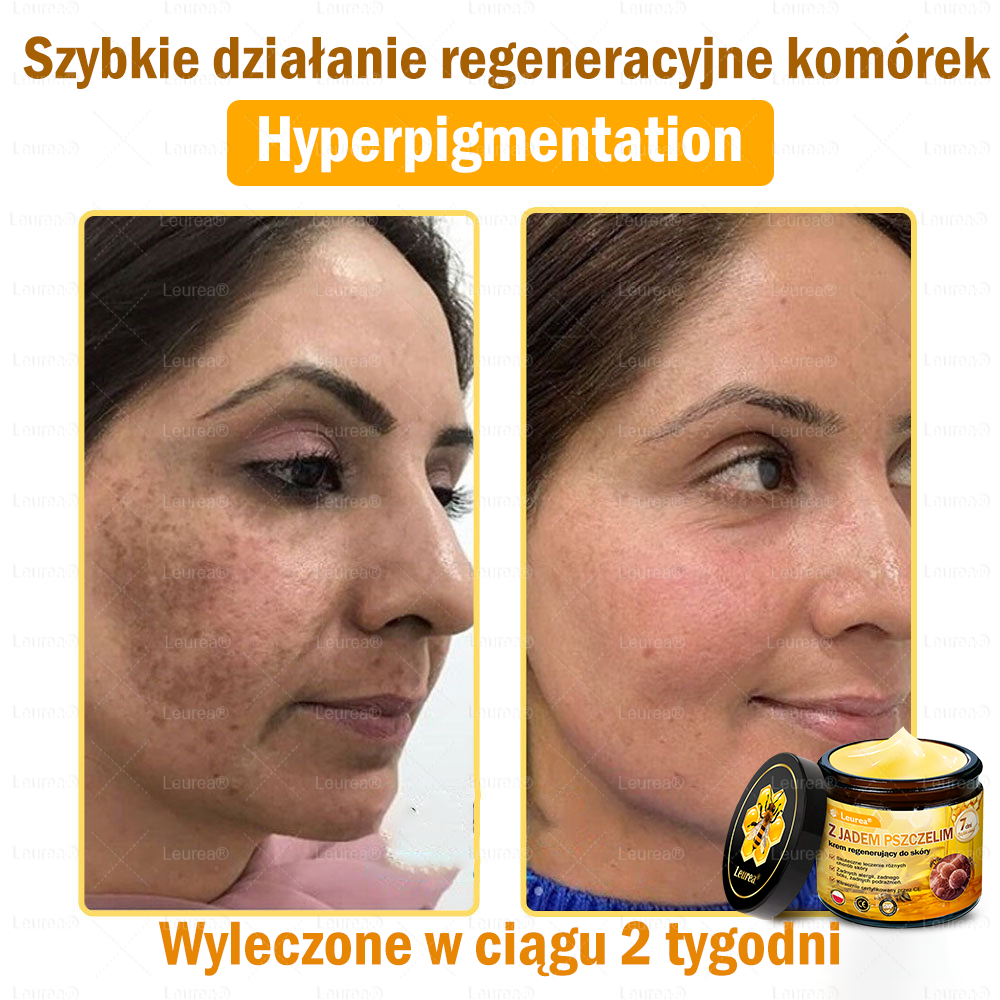 ✨✨✨Leurea® Krem Regenerujący z Jadem Pszczelim🔥 Naturalna regeneracja skóry, wygładzenie zmarszczek i promienna cera-50 ml