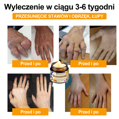 ✨🐝✨𝑺𝒕𝒂𝒘𝑽𝒊𝒕𝒂𝒍™ Krem z Jadem Pszczelim Leczniczy do Regeneracji Stawów - Zalecane przez Polskie Towarzystwo Ortopedyczne i Traumatologiczne