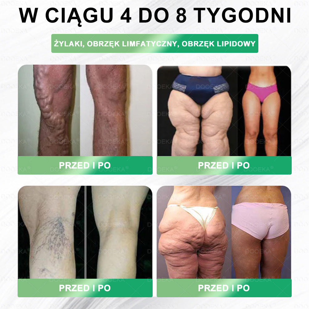 🍏🍏DOOEKA® GLP-1 8 w 1 Fit & Vital roztwór doustny – Raz dziennie, widoczne zmiany w ciągu 7 dni / W przypadku otyłości, zdrowia serca i układu krążenia, cukrzycy, bezdechu sennego, zdrowia jelit, problemów ze stawami i wielu innych