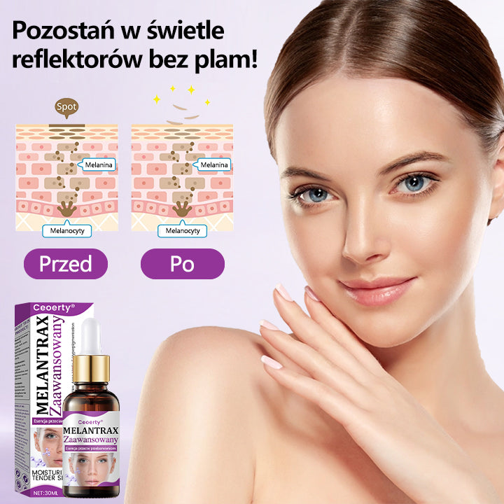💜 Ceoerty® MelantraX Zaawansowana esencja przeciw przebarwieniom ✅ Skuteczna walka z przebarwieniami, ciemnymi plamami i nierównym kolorytem skóry
