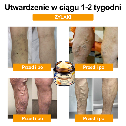 ✨🐝✨𝑺𝒕𝒂𝒘𝑽𝒊𝒕𝒂𝒍™ Krem z Jadem Pszczelim Leczniczy do Regeneracji Stawów - Zalecane przez Polskie Towarzystwo Ortopedyczne i Traumatologiczne
