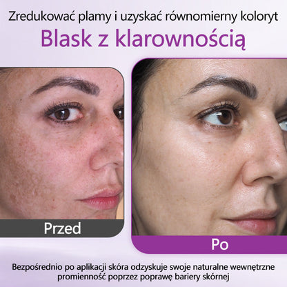 💜 Ceoerty® MelantraX Zaawansowana esencja przeciw przebarwieniom ✅ Skuteczna walka z przebarwieniami, ciemnymi plamami i nierównym kolorytem skóry