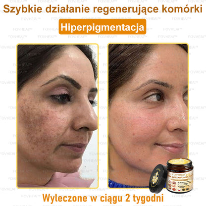 🐝FOVHEAl™ Krem wielofunkcyjny z jadem pszczelim - Polecane przez dermatologów – Odpowiednie dla każdego wieku