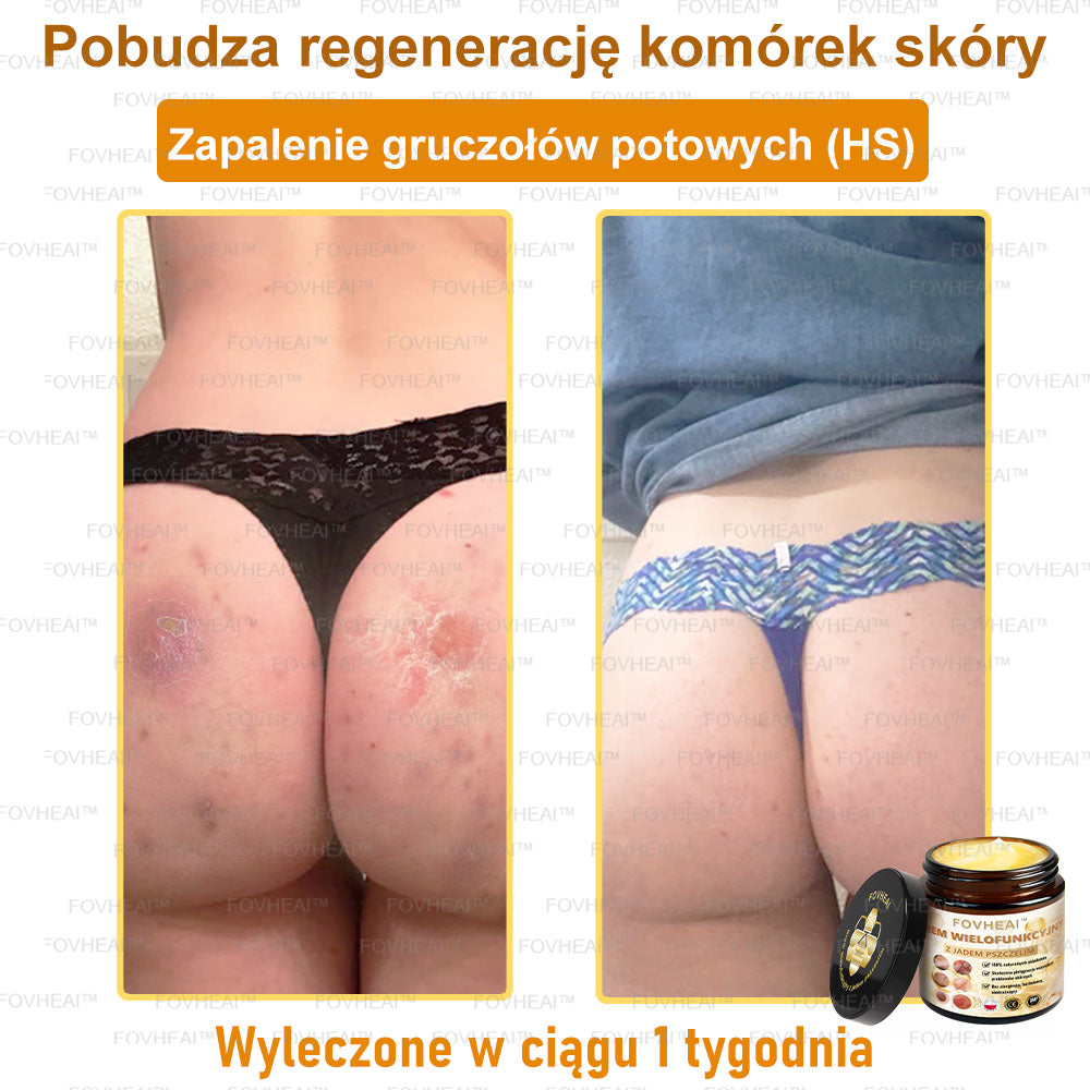 🐝FOVHEAl™ Krem wielofunkcyjny z jadem pszczelim - Polecane przez dermatologów – Odpowiednie dla każdego wieku