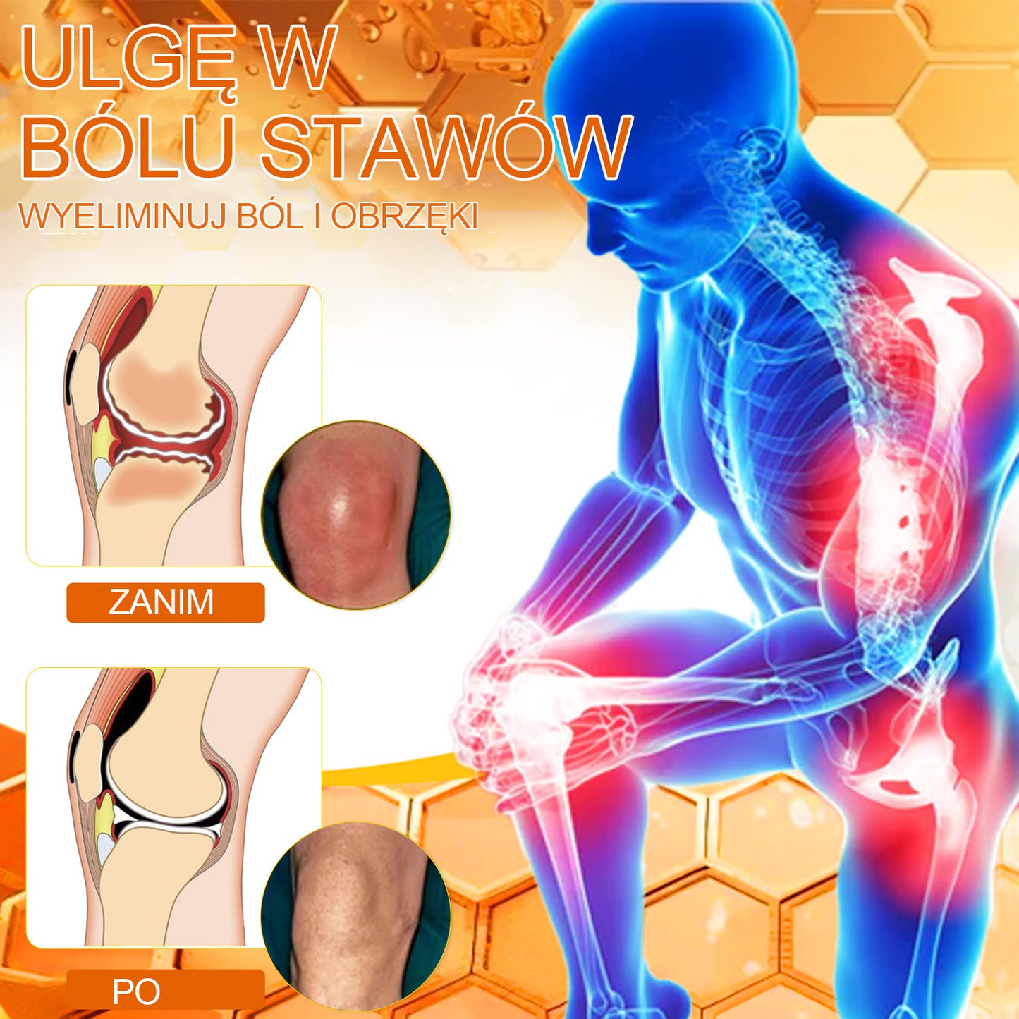 ✨🐝✨𝑺𝒕𝒂𝒘𝑽𝒊𝒕𝒂𝒍™ Krem z Jadem Pszczelim Leczniczy do Regeneracji Stawów - Zalecane przez Polskie Towarzystwo Ortopedyczne i Traumatologiczne