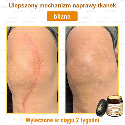 🐝FOVHEAl™ Krem wielofunkcyjny z jadem pszczelim - Polecane przez dermatologów – Odpowiednie dla każdego wieku